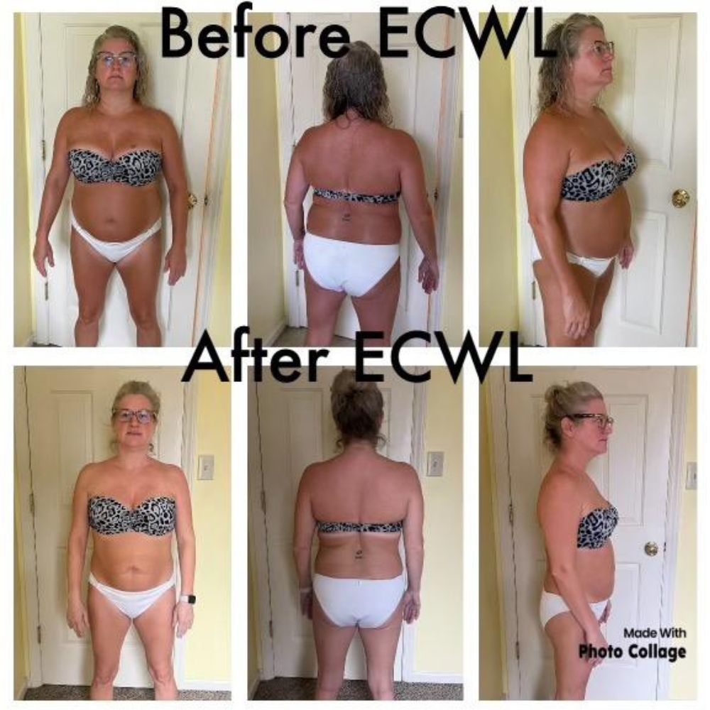 Weight Loss Before and After