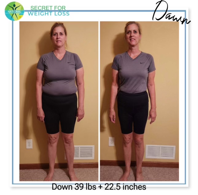 Dawn SWL Before_After