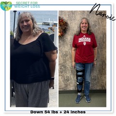 Nancie SWL Before and After